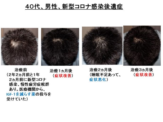 新型コロナ感染後遺症　病院